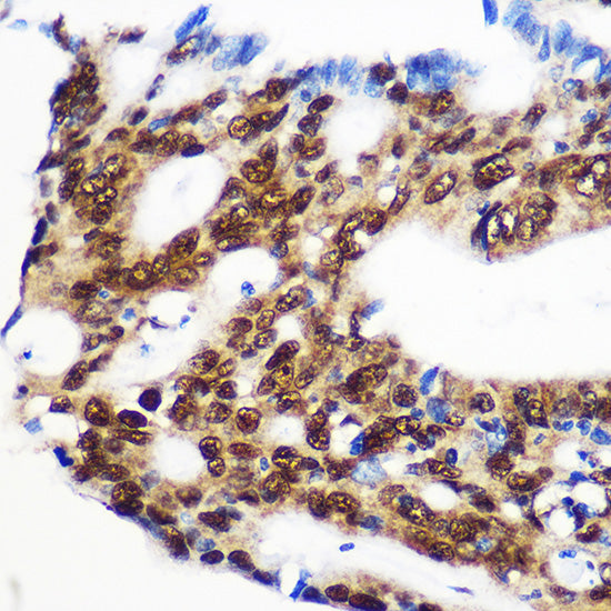 RBM15 Rabbit pAb