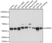 LMAN1 Rabbit mAb
