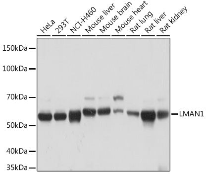 LMAN1 Rabbit mAb