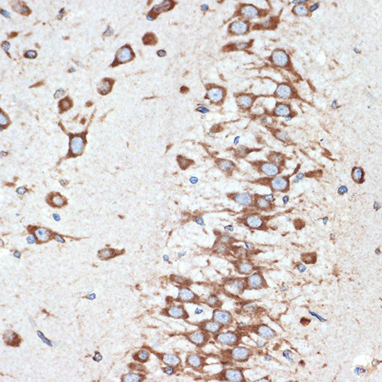 LMAN1 Rabbit mAb