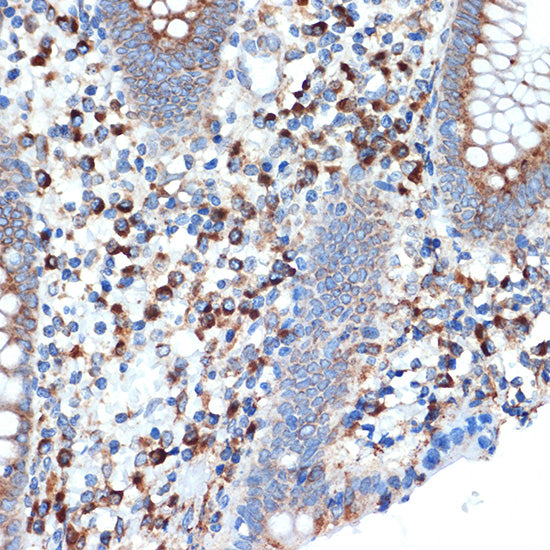 LMAN1 Rabbit mAb