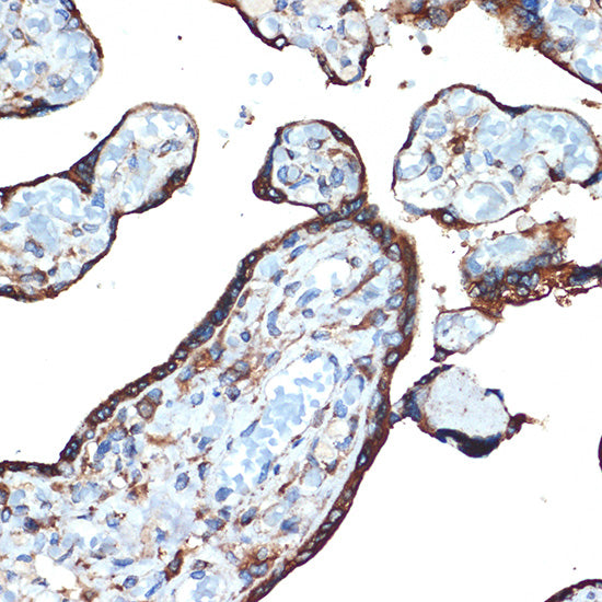 LMAN1 Rabbit mAb