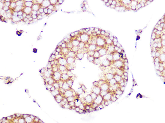 Clathrin heavy chain Rabbit mAb