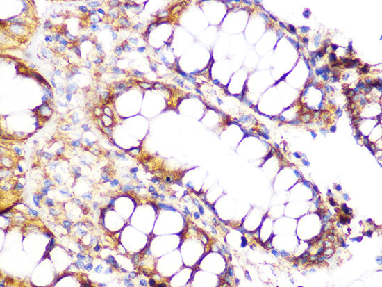 Clathrin heavy chain Rabbit mAb