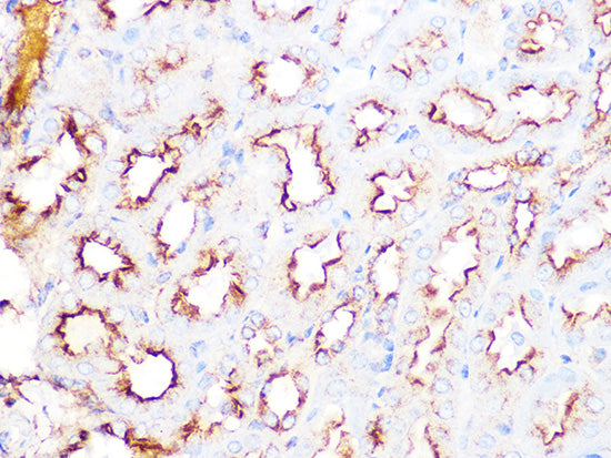 Clathrin heavy chain Rabbit mAb
