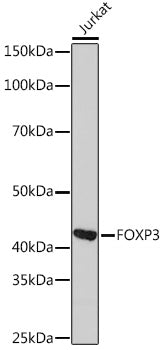 FOXP3 Rabbit mAb