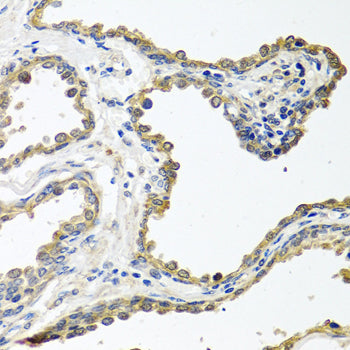 COLEC11 Rabbit pAb