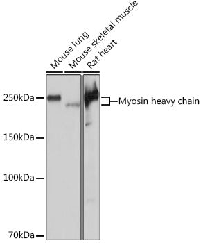 Myosin heavy chain Rabbit mAb