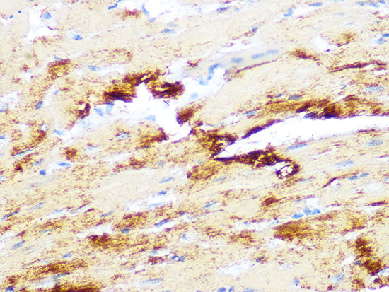 Myosin heavy chain Rabbit mAb