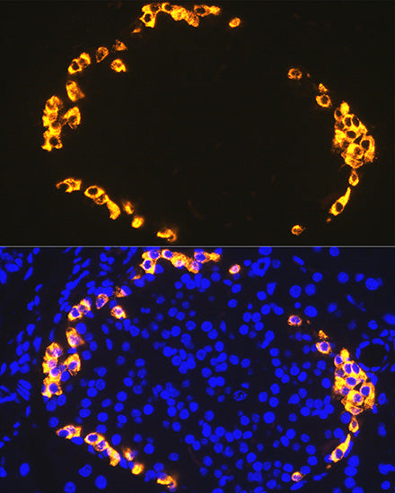 GLP-1 Rabbit mAb