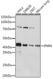 PAR4 Rabbit mAb