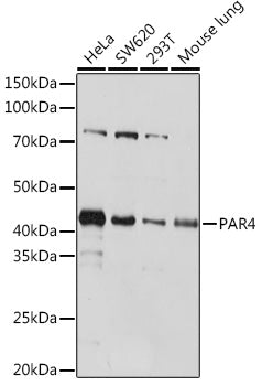 PAR4 Rabbit mAb