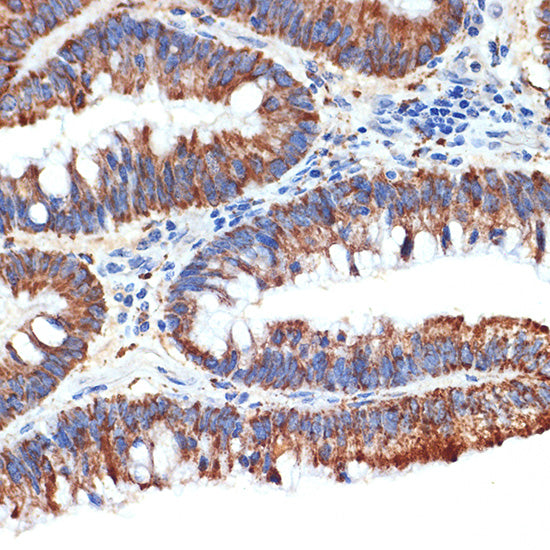 PAR4 Rabbit mAb