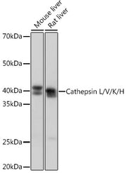 Cathepsin L/V/K/H Rabbit mAb