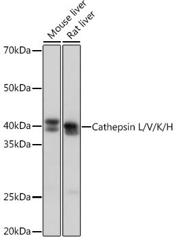 Cathepsin L/V/K/H Rabbit mAb