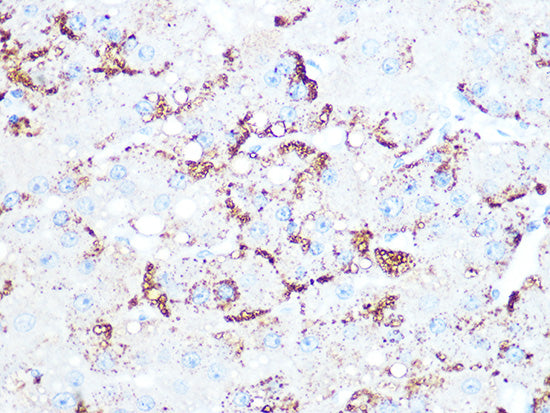 Cathepsin L/V/K/H Rabbit mAb