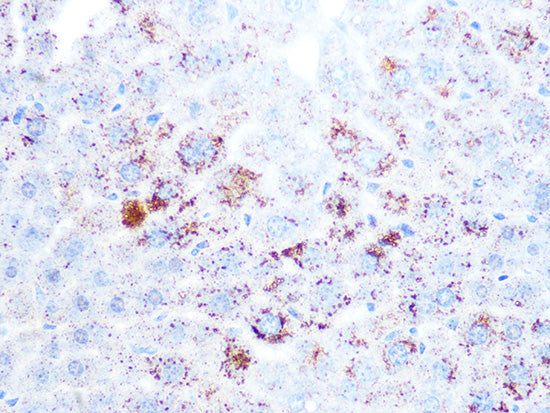 Cathepsin L/V/K/H Rabbit mAb