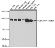 CD62P/P-selectin Rabbit mAb