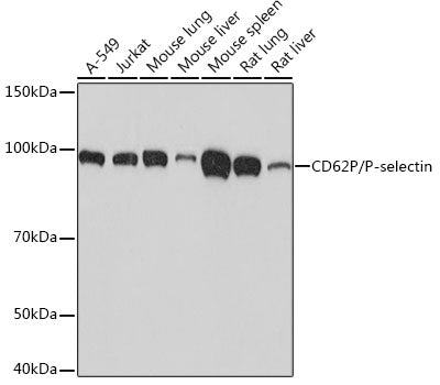 CD62P/P-selectin Rabbit mAb
