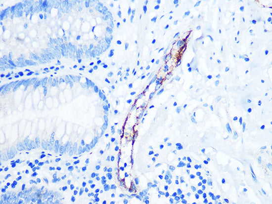 CD62P/P-selectin Rabbit mAb