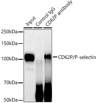 CD62P/P-selectin Rabbit mAb