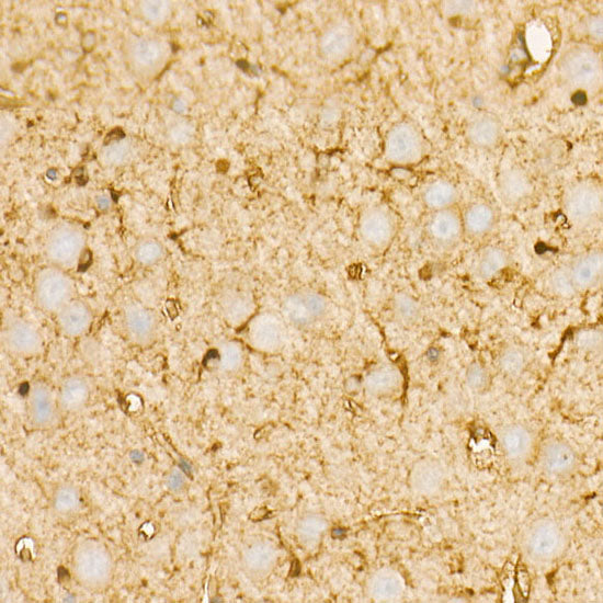 PI3 Kinase p85 alpha Rabbit mAb