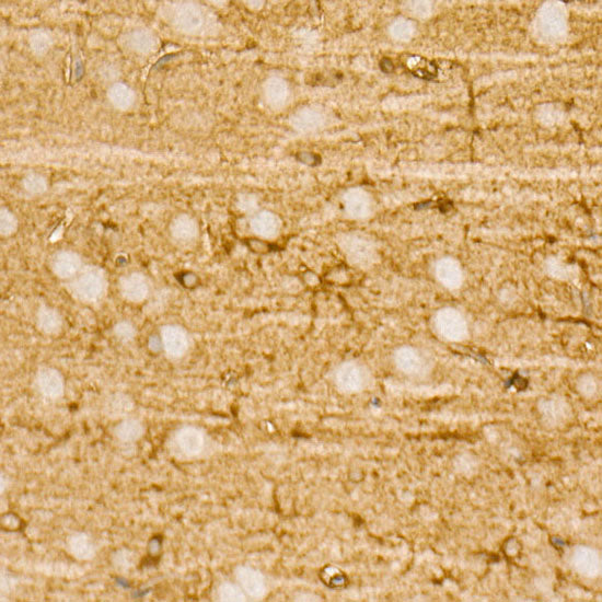 PI3 Kinase p85 alpha Rabbit mAb