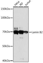 Lamin B2 Rabbit mAb