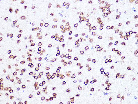 Lamin B2 Rabbit mAb