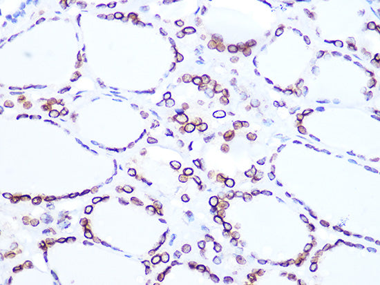 Lamin B2 Rabbit mAb