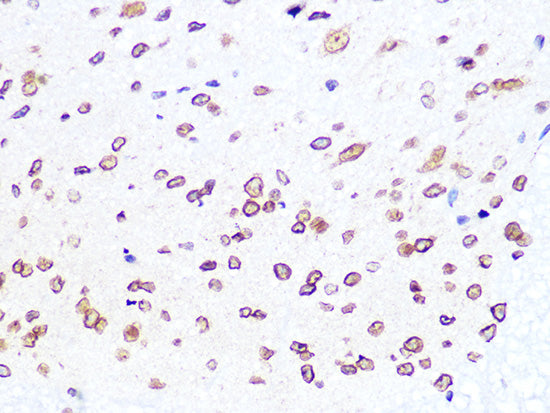 Lamin B2 Rabbit mAb