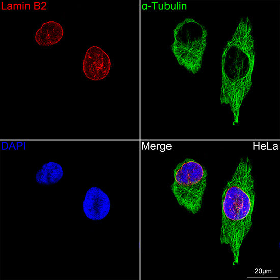Lamin B2 Rabbit mAb