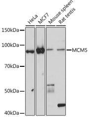 MCM5 Rabbit mAb
