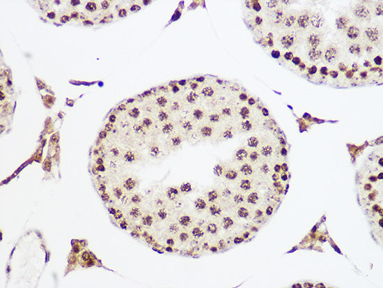 MCM5 Rabbit mAb