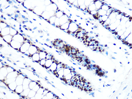 MCM5 Rabbit mAb