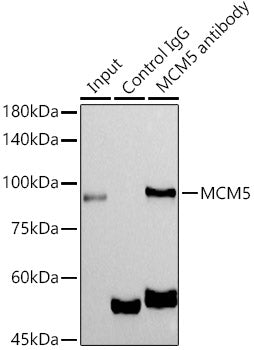 MCM5 Rabbit mAb