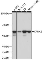 KPNA2 Rabbit mAb