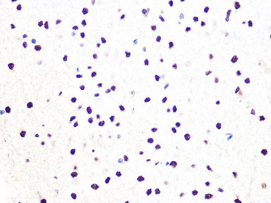 DDB1 Rabbit mAb