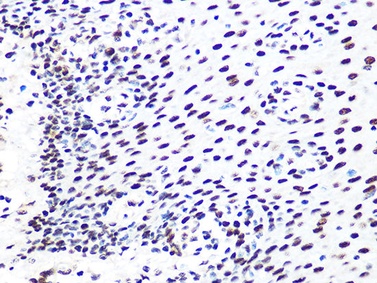 DDB1 Rabbit mAb