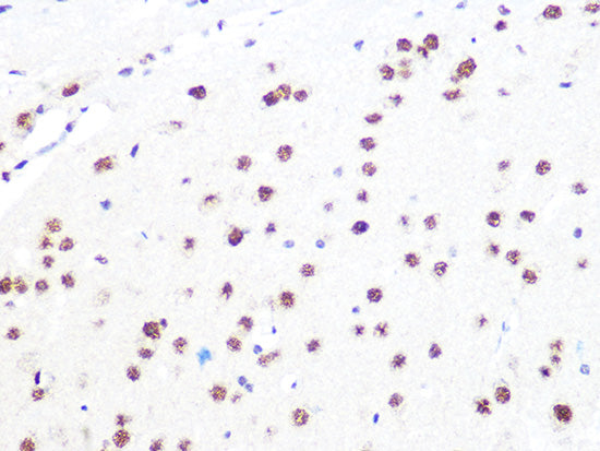 DDB1 Rabbit mAb