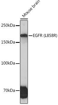 EGFR (L858R) Rabbit mAb