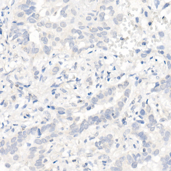 EGFR (L858R) Rabbit mAb