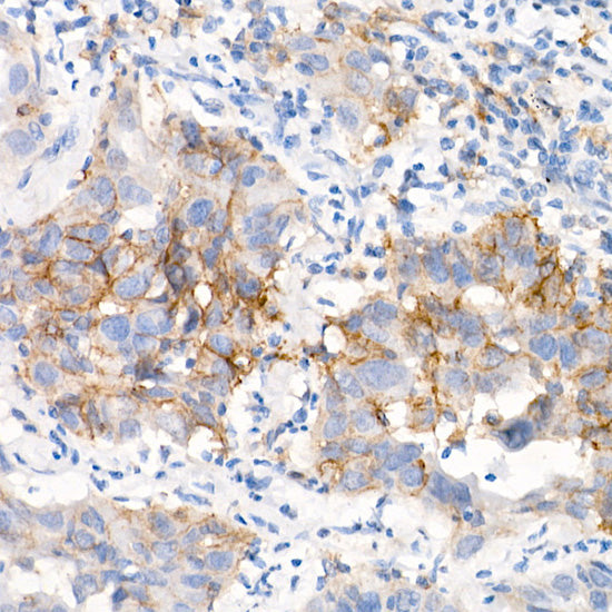 EGFR (L858R) Rabbit mAb