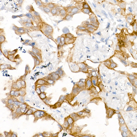 EGFR (L858R) Rabbit mAb