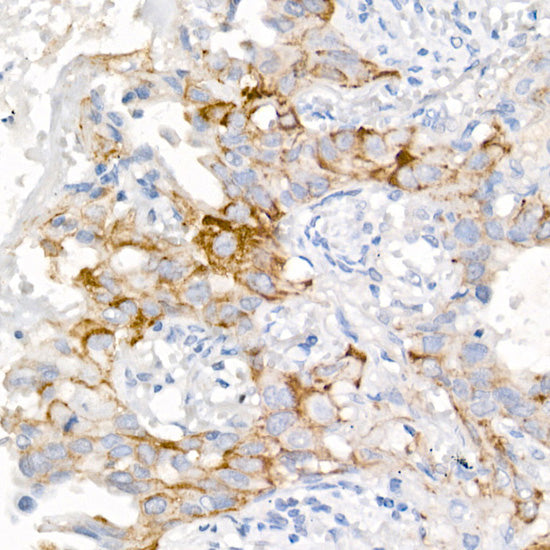 EGFR (L858R) Rabbit mAb