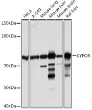 CYPOR Rabbit mAb