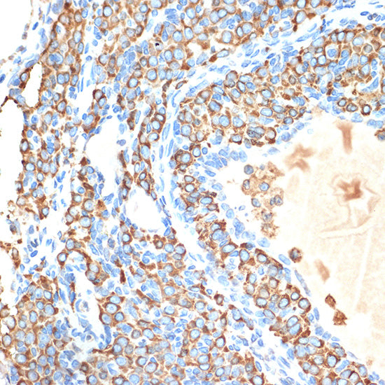 CYPOR Rabbit mAb