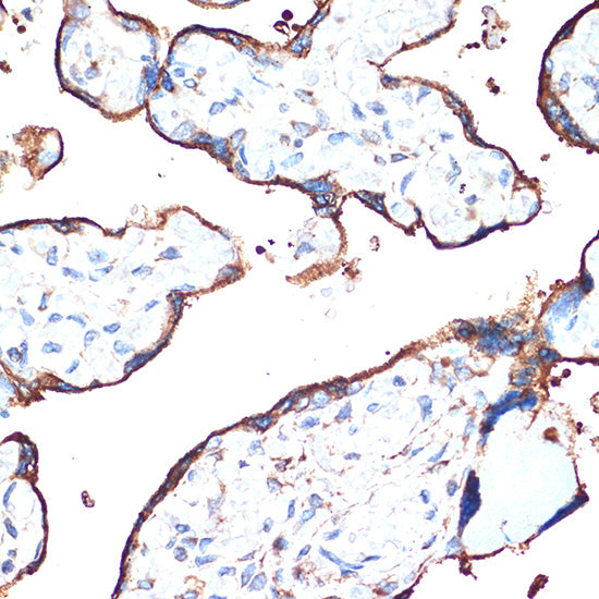 CYPOR Rabbit mAb