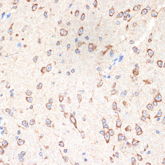 CYPOR Rabbit mAb