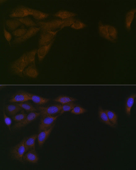 CYPOR Rabbit mAb